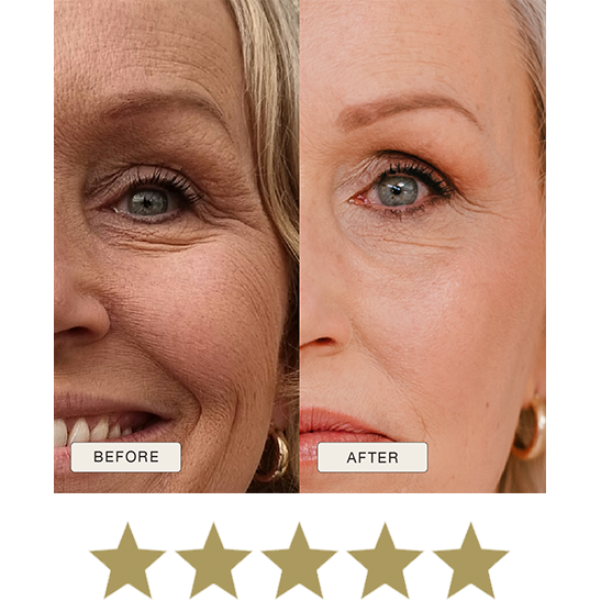 i_NaturalMagic_Before_After_Alma_NL_2025_withstars