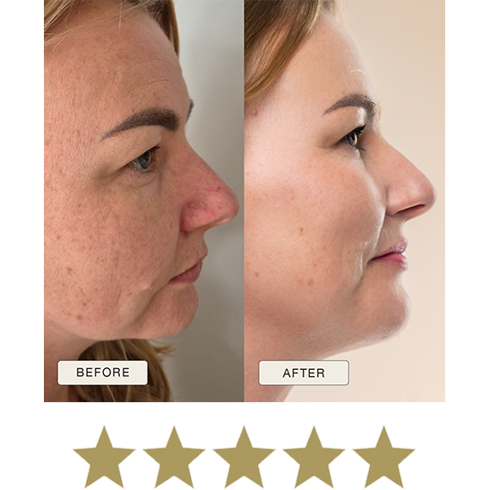 i_NaturalMagic_Before_After_Beata_PL_2025_withstars