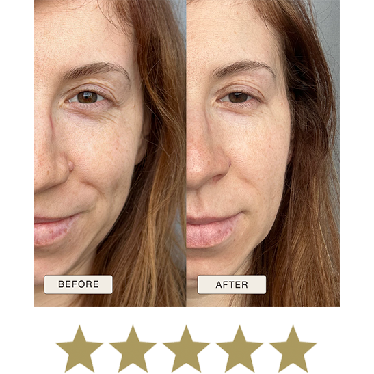 i_NaturalMagic_Before_After_Patryija_PL_2025_withstars