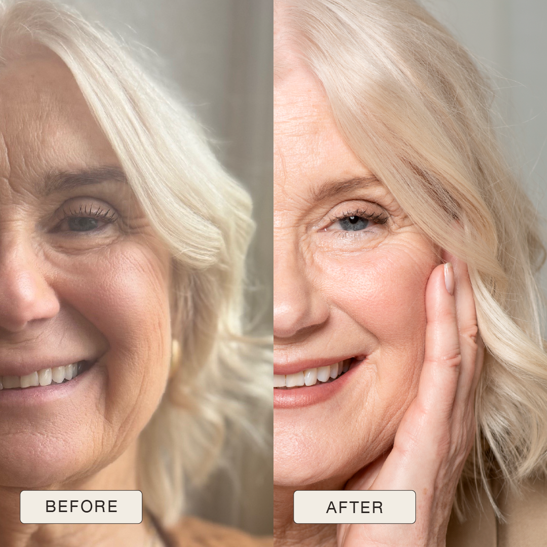 i_NaturalMagic_Before_After_Anna_2025-10