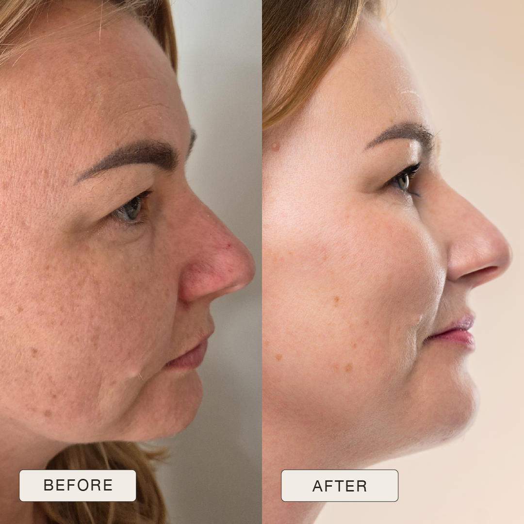 i_NaturalMagic_Before_After_Beata_PL_2025