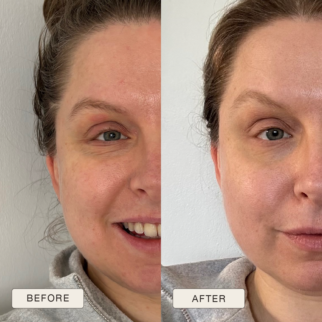 i_NaturalMagic_Before_After_Laura_2025