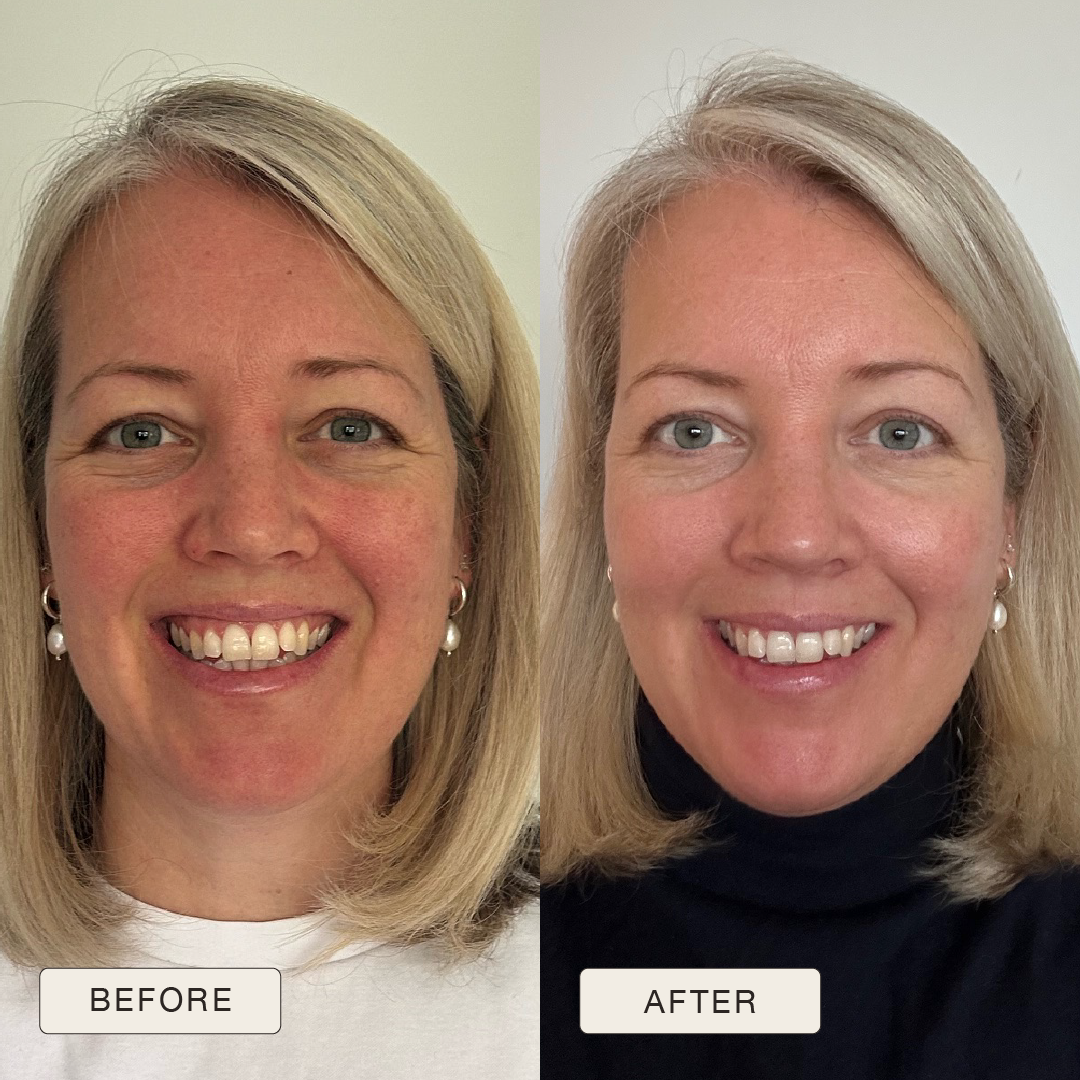 i_NaturalMagic_Before_After_Rebecca_2025