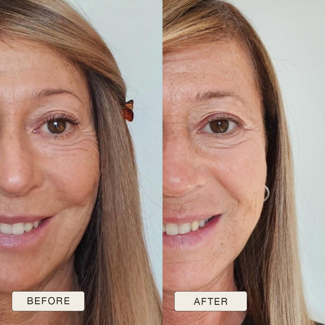 i_NaturalMagic_Before_After_Rossanna_2025-09
