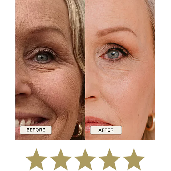 i_NaturalMagic_Before_After_Alma_NL_2025_withstars