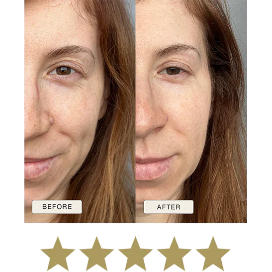 i_NaturalMagic_Before_After_Patryija_PL_2025_withstars