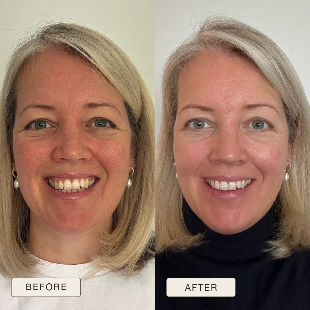 i_NaturalMagic_Before_After_Rebecca_2025