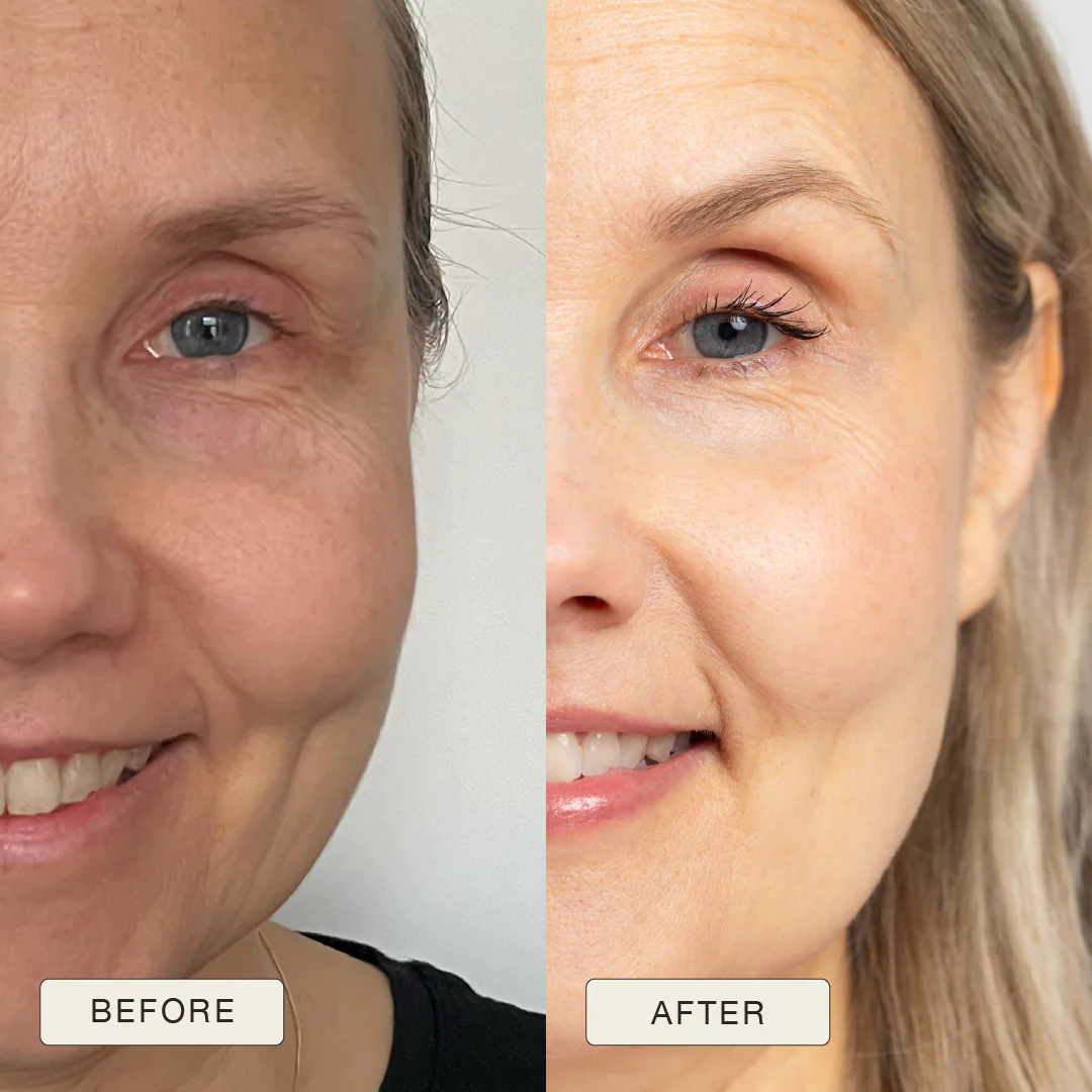i_NaturalMagic_Before_After_Teija_FI_2025